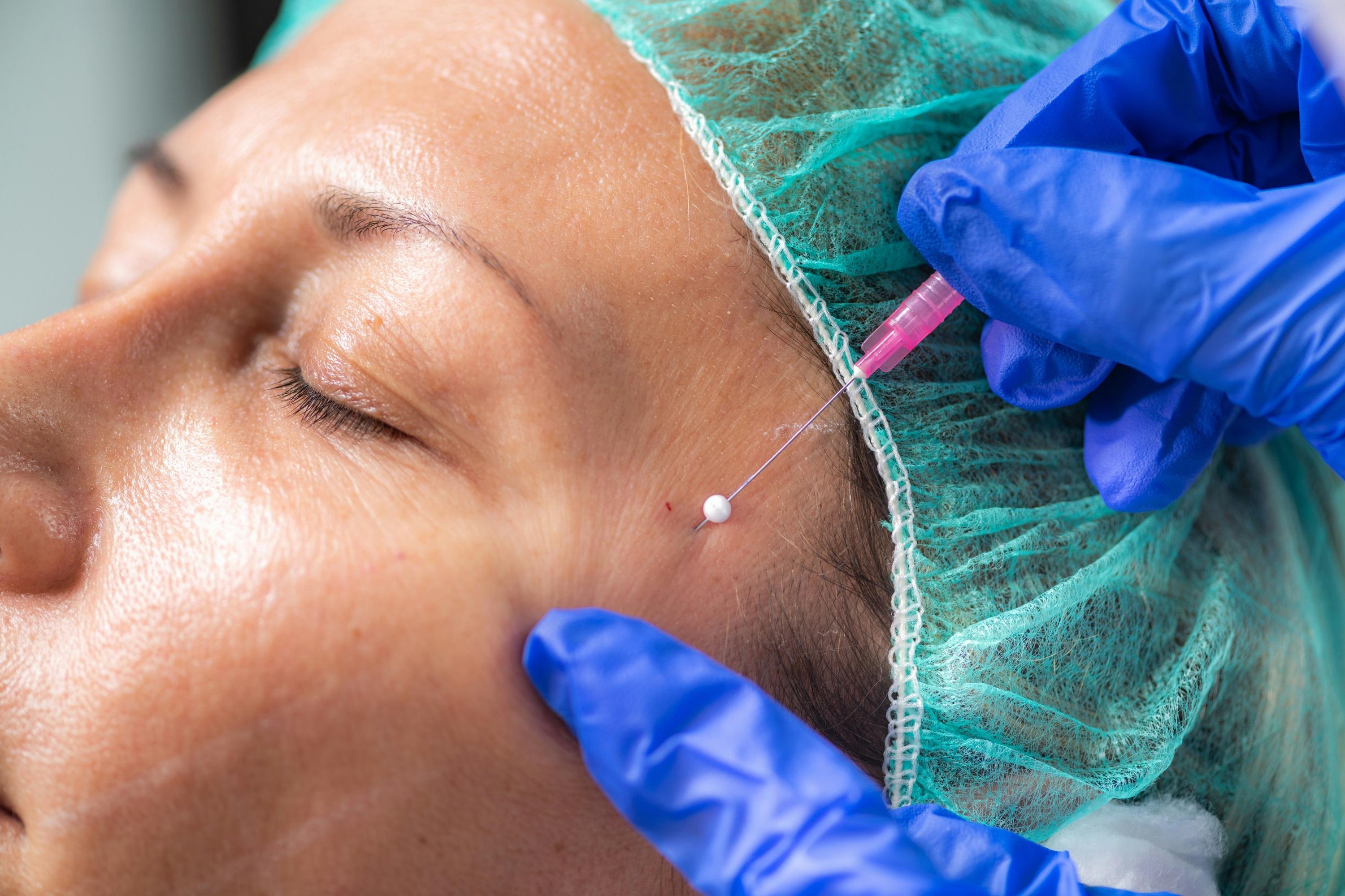 Le métier de dermatologue
