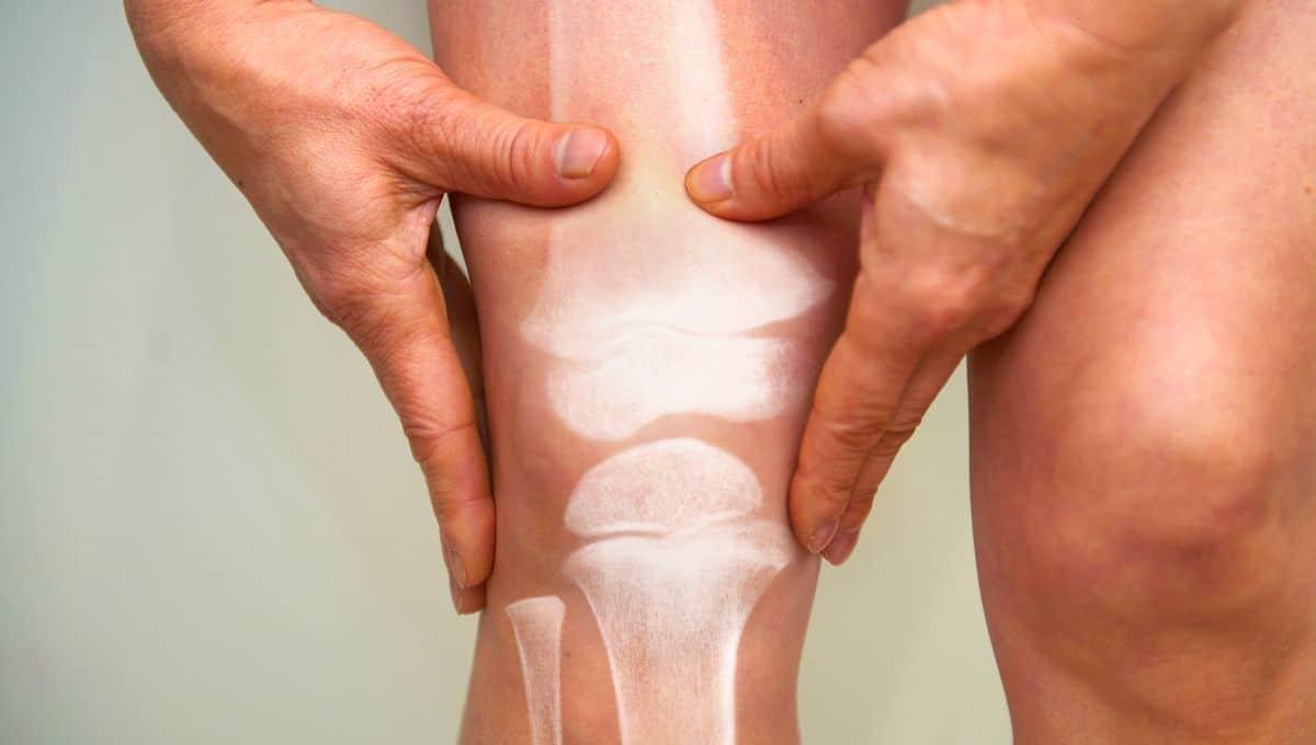 Faut-il une ordonnance pour consulter un rhumatologue en France ?