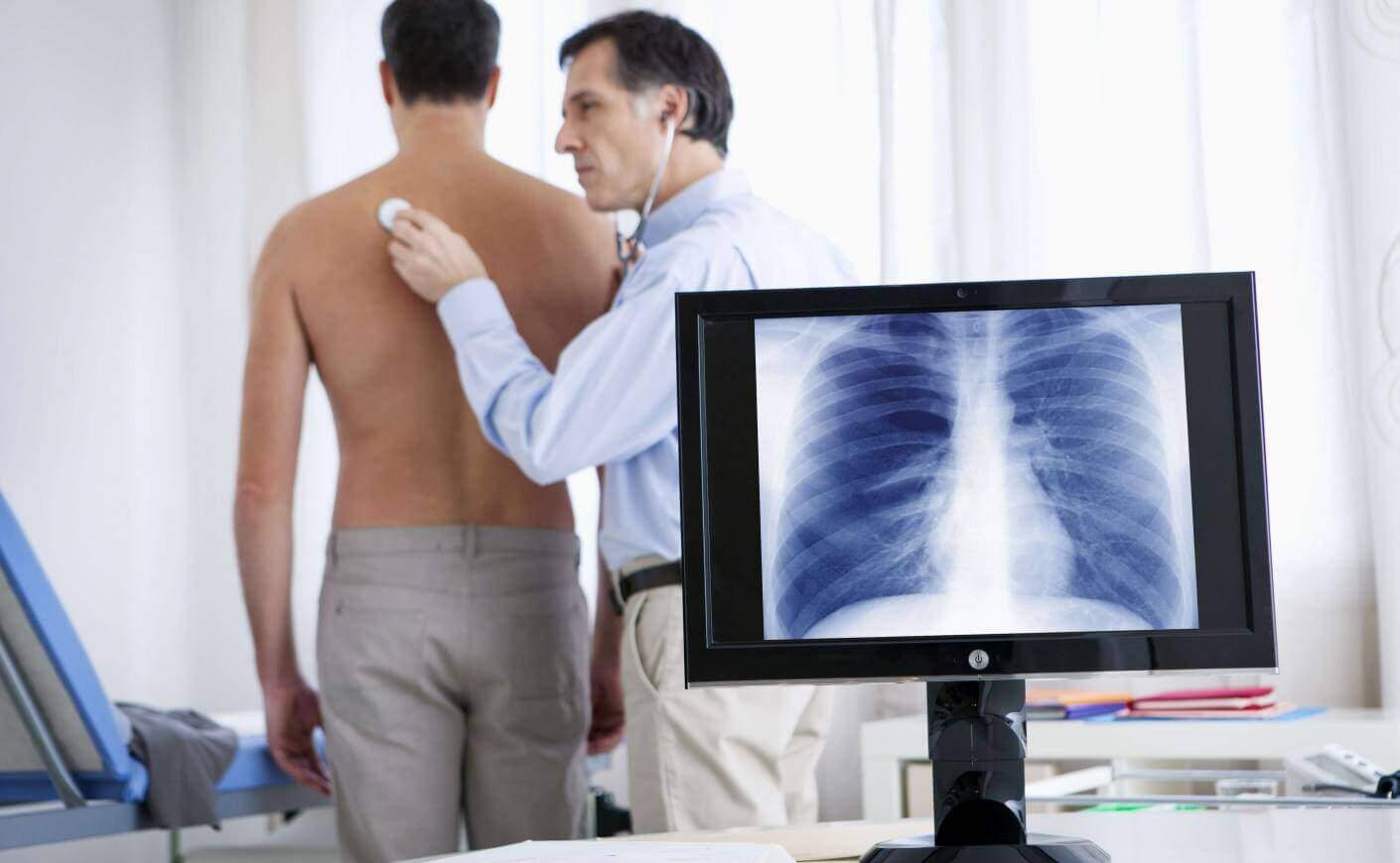 Faut-il une ordonnance pour consulter un pneumologue ?